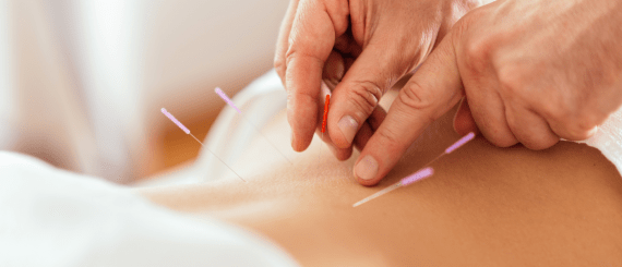 Acupuncture and Massage Therapy: What RMTs/MTs Should Know